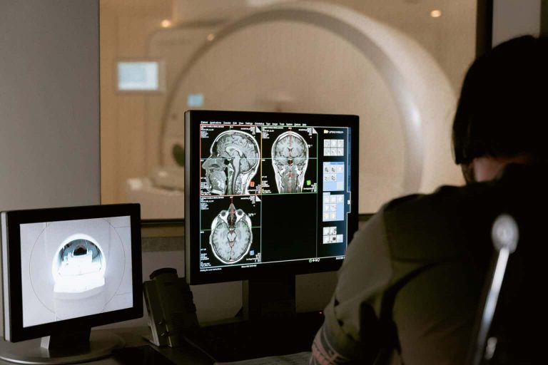 Agilidade nos exames de AVC: inteligência artificial ajuda